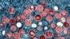 Suécia confirma primeiro caso de nova estirpe de mpox fora de África

