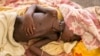 FILE - A severely malnourished child lies in bed at a Doctors Without Borders hospital Bentiu, South Sudan, July 3, 2014.