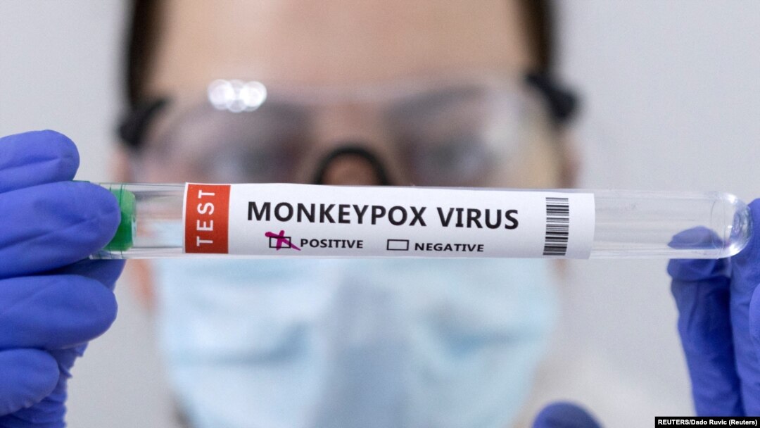 Tubo de una prueba positiva de viruela del mono tomada el 23 de mayo de 2022. Foto Reuters.
