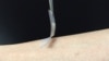 The "smart insulin patch," developed by researchers in the joint UNC/NC State Biomedical Engineering Department. (Credit: The lab of Zhen Gu, Ph.D.)