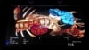 Virtual Medicine Takes Shape with Floating Body Parts