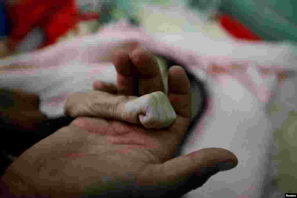 Saleh Hassan al-Faqeh holds the hand of his four-month-old daughter, Hajar, who died at the malnutrition ward of al-Sabeen hospital in Sana'a, Yemen. Fouad al-Reme, a nurse in the hospital, said Hajar was conscious when she came to the hospital but she suffered low oxygen levels. "She was like skin on bones, her body was emaciated," he said.