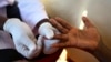 Scientists Achieve 'Functional Cure' for HIV in Monkey Model 