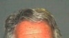 Epstein's Death Was Suicide, Medical Examiner Says