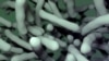 Multiple antibiotic-resistant strains of Clostridium difficile have recently emerged. Researchers have found a non-antibiotic drug that could help combat C. difficile infection. (Credit: V. Altounian/Science Translational Medicine)